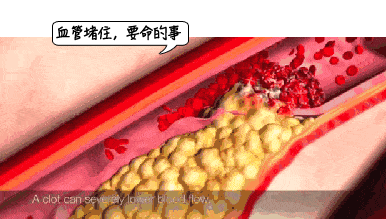 04.gif