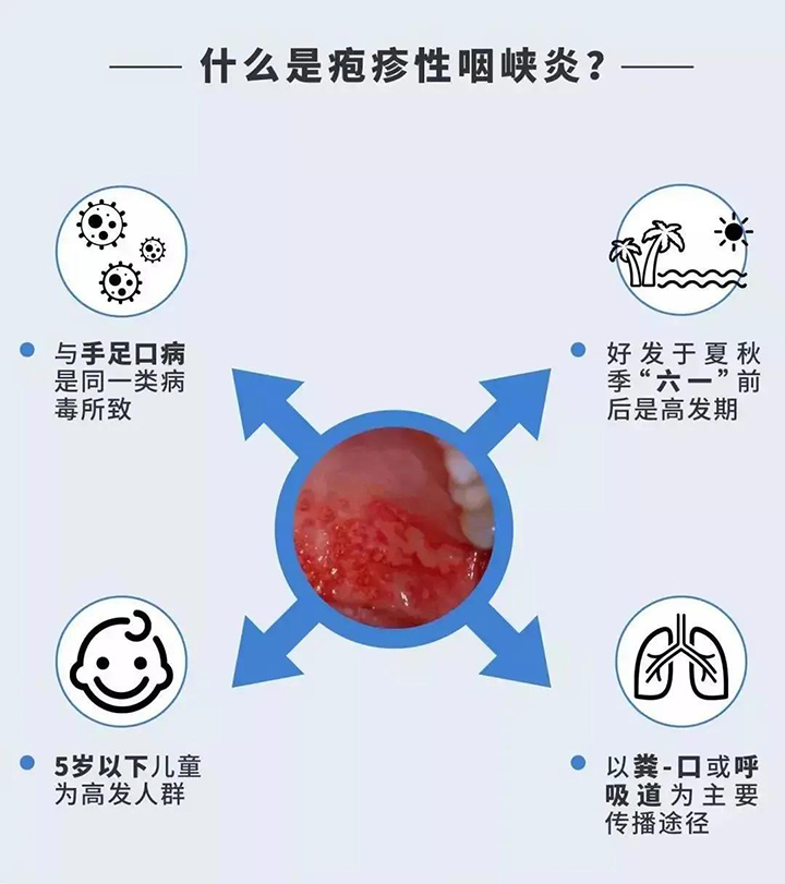 疱疹性咽峡炎病程图片