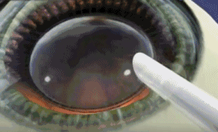 06.gif