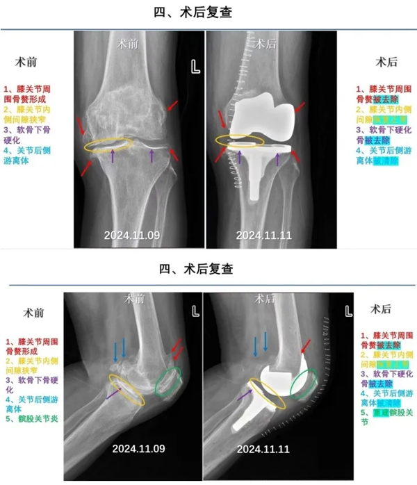 术后复查